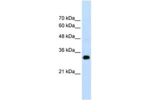 Western Blotting (WB) image for anti-Ring Finger Protein 121 (RNF121) antibody (ABIN2462677)