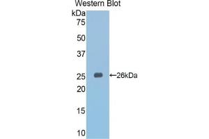 Detection of Recombinant Slit3, Mouse using Polyclonal Antibody to Slit Homolog 3 (Slit3) (SLIT3 antibody  (AA 1348-1517))