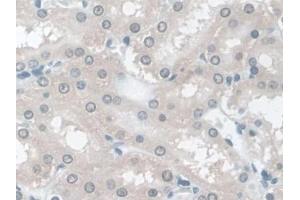 DAB staining on IHC-P; Samples: Rat Kidney Tissue (TPSB2 antibody  (AA 30-274))
