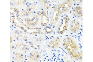 Immunohistochemistry of paraffin-embedded Rat kidney using ATP7A Polyclonal Antibody at dilution of 1:100 (40x lens). (ATP7A antibody)