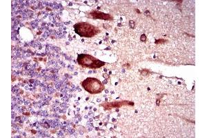 Immunohistochemical analysis of paraffin-embedded cerebellum tissues using KEAP1 mouse mAb with DAB staining.