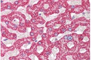 Immunohistochemistry (IHC) image for anti-Polymerase (RNA) II (DNA Directed) Polypeptide B, 140kDa (POLR2B) (AA 805-854) antibody (ABIN6736747)