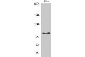 Western Blot analysis of Hela cells with Phospho-eEF2K (Ser366) Polyclonal Antibody at dilution of 1:1000 (EEF2K antibody  (pSer366))