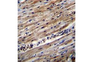 Formalin fixed and paraffin embedded human heart tissue reacted with DUS1L Antibody (C-term) followed by peroxidase conjugation of the secondary antibody and DAB staining. (DUS1L antibody  (C-Term))