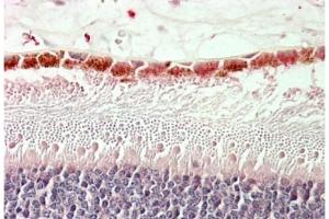 Staining of paraffin embedded Human Retina using RDH5 antibody at 5 µg/ml. (RDH5 antibody  (Internal Region))