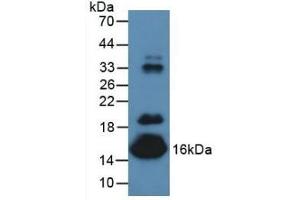 Detection of PALB in Mouse Serum using Polyclonal Antibody to Prealbumin (PALB) (TTR antibody  (AA 21-147))
