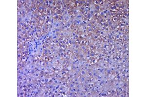 Paraformaldehyde-fixed, paraffin embedded Rat liver, Antigen retrieval by boiling in sodium citrate buffer (pH6. (CCR2 antibody  (AA 301-373))