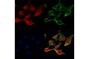 ABIN6265813 and ABIN6272621 staining Hela cells by IF/ICC.