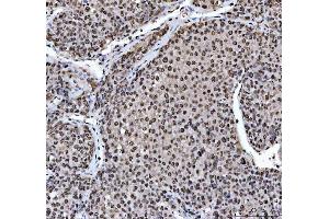IHC analysis of HNRNPL using anti-HNRNPL antibody (ABIN4886624). (HNRNPL antibody  (C-Term))