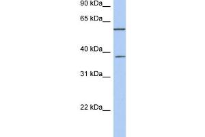 WB Suggested Anti-NUP43 Antibody Titration: 0. (NUP43 antibody  (Middle Region))