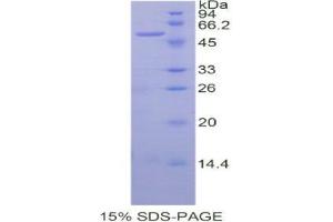 SDS-PAGE (SDS) image for Sialic Acid Acetylesterase (SIAE) (AA 22-244) protein (His tag,GST tag) (ABIN2123605)