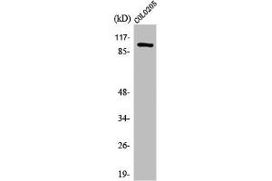 Western Blot analysis of COLO205 cells using Synphilin-1 Polyclonal Antibody (SNCAIP antibody  (C-Term))