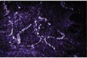 Immunofluorescence staining of L6 cells (rat skeletal muscle myoblasts, ATCC CRL-1458). (Rab4 antibody  (AA 97-213))