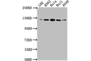 Western Blot Positive WB detected in: L02 whole cell lysate, K562 whole cell lysate, Hela whole cell lysate, Raji whole cell lysate, A549 whole cell lysate All lanes: ACLY antibody at 1:1500 Secondary Goat polyclonal to rabbit IgG at 1/50000 dilution Predicted band size: 121, 120, 92 kDa Observed band size: 120 kDa