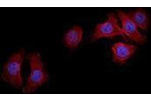 Immunofluorescence (IF) image for anti-Epidermal Growth Factor Receptor (EGFR) antibody (Alexa Fluor 594) (ABIN2656842) (EGFR antibody  (Alexa Fluor 594))