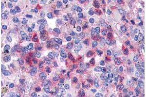 Human Spleen: Formalin-Fixed, Paraffin-Embedded (FFPE) (SGK3 antibody  (AA 107-156))