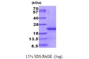 SDS-PAGE (SDS) image for CD300e Molecule (CD300E) (AA 18-173) protein (His tag) (ABIN5853943) (CD300E Protein (AA 18-173) (His tag))