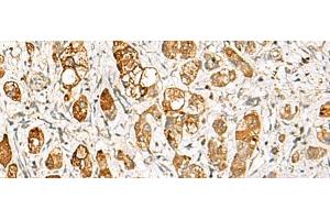 RIMS3 antibody