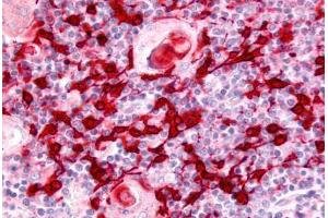 Human Thymus (formalin-fixed, paraffin-embedded) stained with USP4 antibody ABIN213586 at 5 ug/ml followed by biotinylated goat anti-rabbit IgG secondary antibody ABIN481713, alkaline phosphatase-streptavidin and chromogen. (USP4 antibody  (Internal Region))