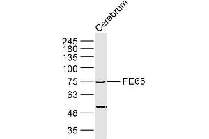 Lane 1: Mouse cerebrum lysates probed with FE65 Polyclonal Antibody, Unconjugated (bs-0110R) at 1:300 overnight at 4˚C. (FE65 antibody  (AA 201-300))
