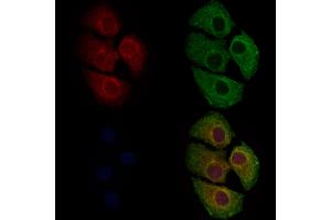 ABIN6262169 and ABIN6279682 staining Hela cells by IF/ICC.