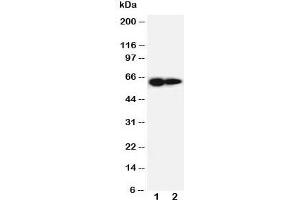 Western blot testing of IL-2 Receptor antibody and Lane 1:  PANC cell lysate ;  2: HeLa cell lysate.