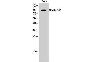 Western Blotting (WB) image for anti-Nuclear Factor of kappa Light Polypeptide Gene Enhancer in B-Cells 2 (NFKB2) (Thr160) antibody (ABIN3185875) (NFKB2 antibody  (Thr160))