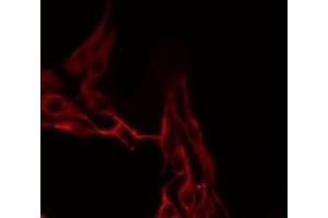 ABIN6276757 staining LOVO by IF/ICC. (MMP13 antibody  (N-Term))
