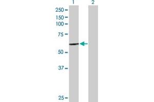 Western Blot analysis of CTSC expression in transfected 293T cell line by CTSC MaxPab polyclonal antibody. (CTSC antibody  (AA 1-463))