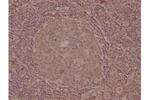 IHC image of ABIN7139747 diluted at 1:100 and staining in paraffin-embedded human tonsil tissue performed on a Leica BondTM system.