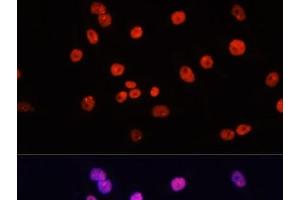 Immunofluorescence analysis of HeLa cells using MYCT1 Polyclonal Antibody at dilution of 1:100. (Myc Target 1 antibody)