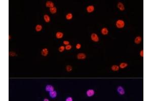 Immunofluorescence analysis of HeLa cells using MYCT1 Polyclonal Antibody at dilution of 1:100.