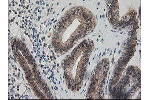 Image no. 1 for anti-Pyridoxal Kinase (PDXK) antibody (ABIN1500145) (PDXK antibody)