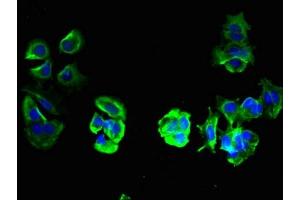 Immunofluorescent analysis of MCF-7 cells using ABIN7173139 at dilution of 1:100 and Alexa Fluor 488-congugated AffiniPure Goat Anti-Rabbit IgG(H+L) (FAM156A antibody  (AA 251-519))