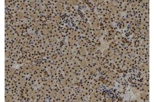 ABIN6273017 at 1/100 staining Mouse kidney tissue by IHC-P. (SYNPO2 antibody  (Internal Region))