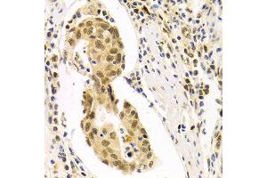 Immunohistochemistry (IHC) image for anti-Discs, Large (Drosophila) Homolog-Associated Protein 5 (DLGAP5) (AA 547-846) antibody (ABIN3023190)