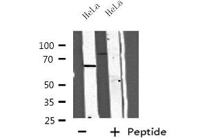 Western blot analysis of extracts from HeLa cells, using CC14A antibody. (CDC14A antibody  (Internal Region))