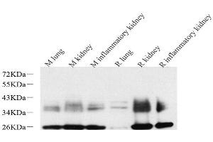 Western Blot analysis of various samples using AQP1 Polyclonal Antibody at dilution of 1:2000. (Aquaporin 1 antibody)