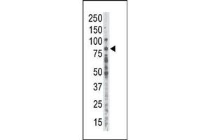 PKC alpha antibody  (C-Term)