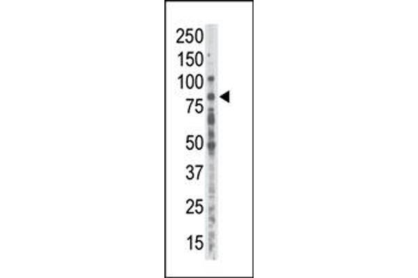 PKC alpha antibody  (C-Term)