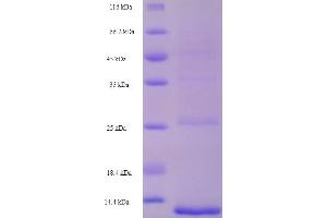 SDS-PAGE (SDS) image for Mitogen-Activated Protein Kinase Kinase Kinase 3 (NP3) (AA 23-91) protein (His tag) (ABIN5710832) (Mitogen-Activated Protein Kinase Kinase Kinase 3 (NP3) (AA 23-91) protein (His tag))