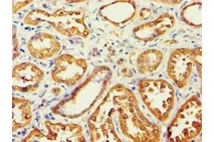 Immunohistochemistry of paraffin-embedded human kidney tissue using ABIN7143588 at dilution of 1:100