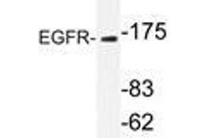 Western blot analysis of EGFR antibody in extracts from Jurkatcells. (EGFR antibody)
