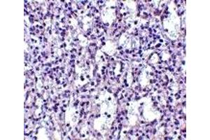 Immunohistochemistry (IHC) image for anti-TBC1 Domain Family, Member 10C (TBC1D10C) (N-Term) antibody (ABIN1031291) (Carabin antibody  (N-Term))