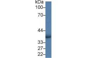 Detection of AIM2 in Human A549 cell lysate using Polyclonal Antibody to Absent In Melanoma 2 (AIM2) (AIM2 antibody  (AA 1-343))