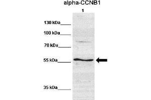 WB Suggested Anti-CCNB1 Antibody  Positive Control: Lane 1:641 µg human NT2 cell line Primary Antibody Dilution: 1:000Secondary Antibody: IRDye 800 CW goat anti-rabbit from Li-COR BioscienceSecondry  Antibody Dilution: 1:00,000Submitted by: Dr. (Cyclin B1 antibody  (C-Term))