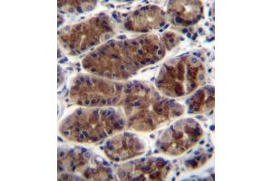 CTGF Antibody (Center) (ABIN392205 and ABIN2841905) immunohistochemistry analysis in formalin fixed and paraffin embedded human stomach tissue followed by peroxidase conjugation of the secondary antibody and DAB staining. (CTGF antibody  (AA 134-159))
