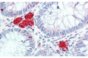 Immunohistochemistry (IHC) image for anti-Hexosaminidase B (Beta Polypeptide) (HEXB) (AA 294-435) antibody (ABIN7438139)