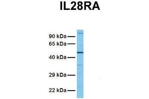 Host:  Rabbit  Target Name:  IL28RA  Sample Tissue:  Human Fetal Lung  Antibody Dilution:  1. (IL28RA antibody  (N-Term))