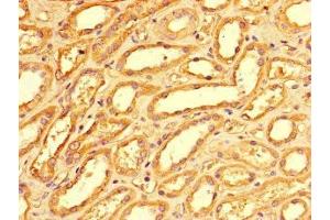 Immunohistochemistry of paraffin-embedded human kidney tissue using ABIN7163088 at dilution of 1:100 (NOXA antibody  (AA 1-136))